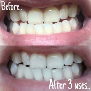 Whitening toothpaste 2 on hand ready to ship♥️